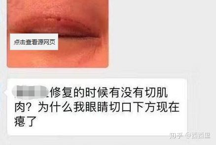 北京割双眼皮最好的医院——专业整形美容医院的卓越之处