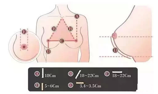 假体隆胸的价格，全面解析费用因素与选择策略