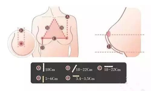 假体隆胸多大，尺寸选择与个人因素的综合考量